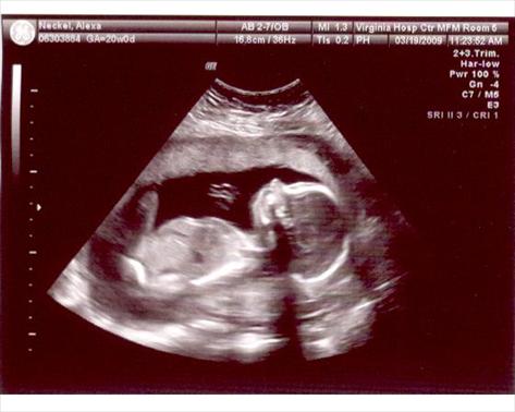 baby 20 weeks